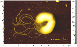  .
Helicobacter pylori.   Helicobacter pylori.     ,  -  .. : Solver P-47 (NT-MDT)